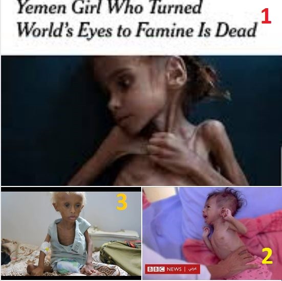 صور طفال اليمن